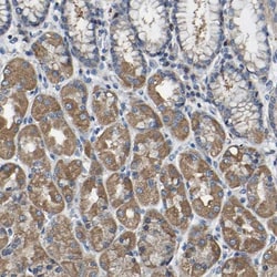 Acylglycerol Kinase Antibody, Novus Biologicals 25 &mu;L; Unlabeled:Antibodies,
